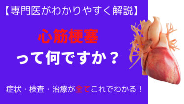 【専門医がわかりやすく解説】心筋梗塞の症状・検査法・治療法の全て